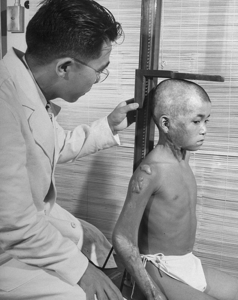 doctor checks on a Hiroshima bombing survivor, 2 years after…