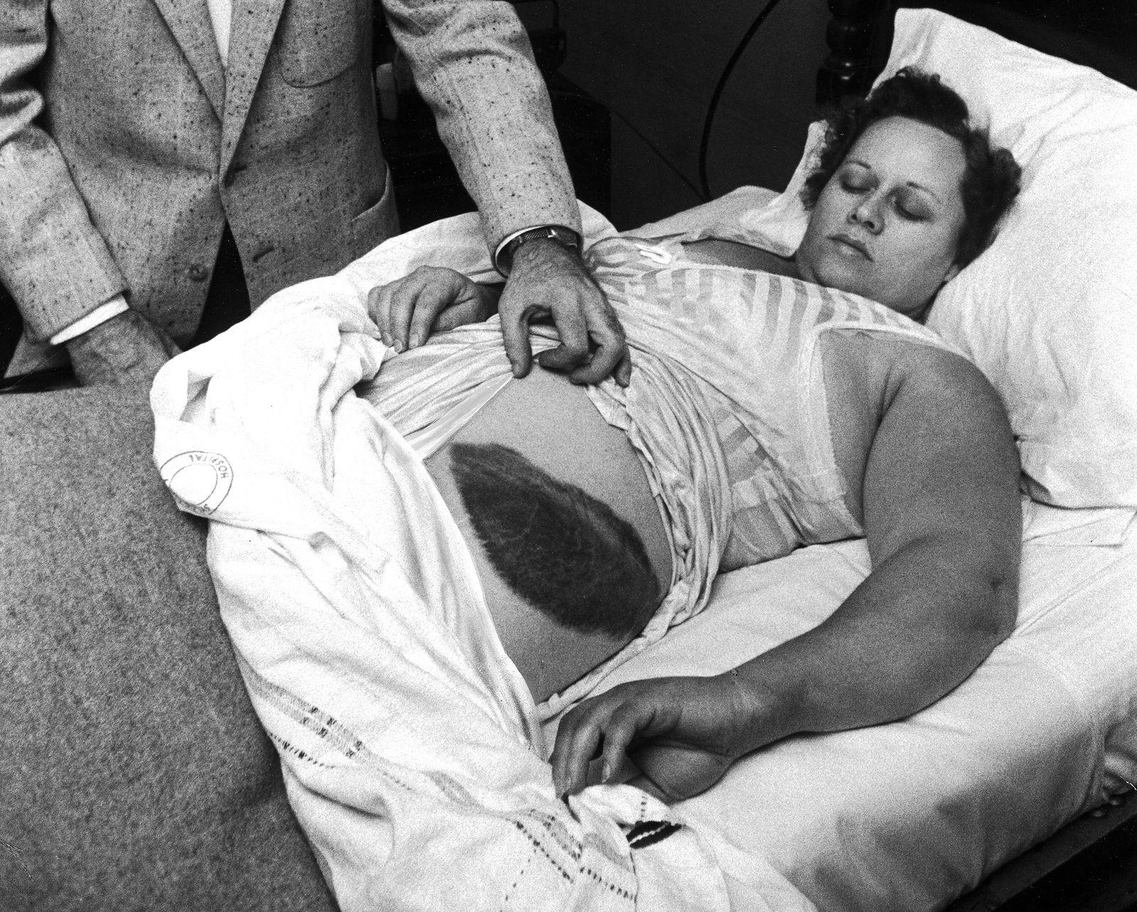 ann Hodges was the only human being in recorded history to be hit by a meteorite 1954 in Sylacauga