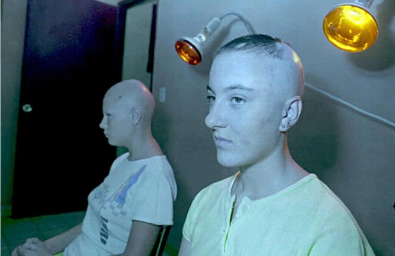 teenagers affected by radiation exposure from the Chernobyl disaster waiting for medical treatment i…